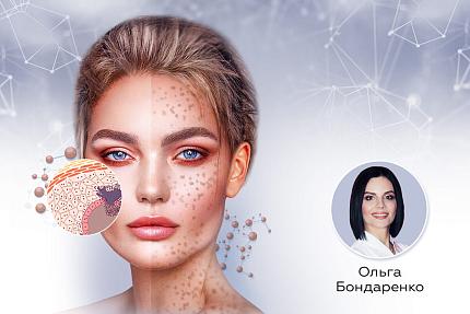 Пигментные пятна, с чего начать лечение?